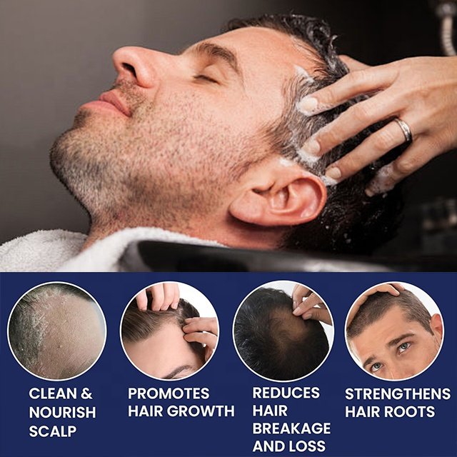 Shampoo Supplier Wholesale Herbal Anti Hair Loss Shampoo China Hair Product For Hair Growth Mens Shampoo
