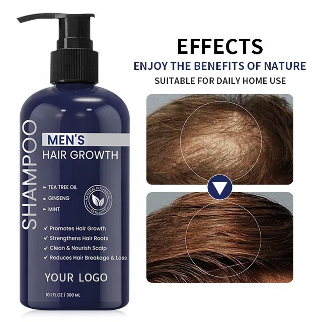 Shampoo Supplier Wholesale Herbal Anti Hair Loss Shampoo China Hair Product For Hair Growth Mens Shampoo