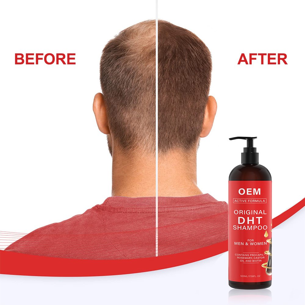 Hair Grow Products Private Label Biotin Rosemary Strengthens Weak And Thinning Oil Control Hair DHT Blocker Shampoo
