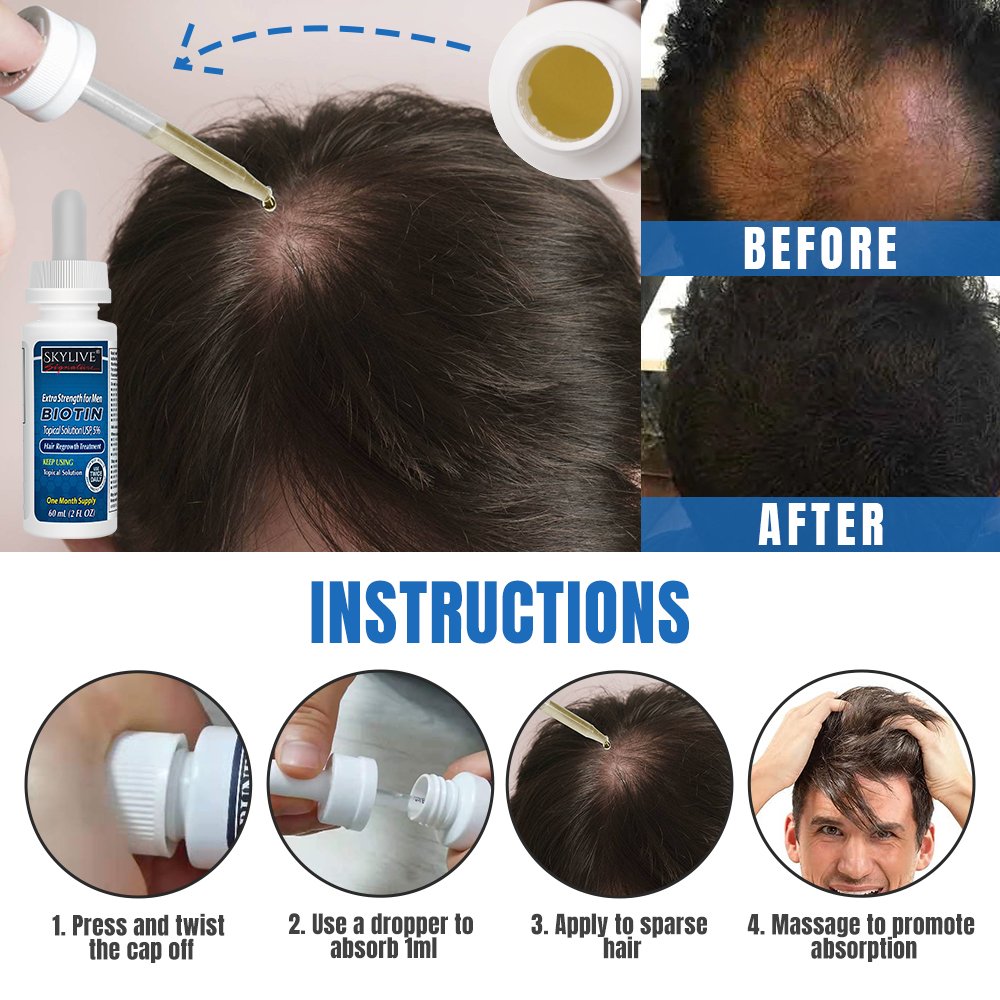 2024 Hot Kirland Hair Growth Serum Oil 5% extra strength 6 months supply for men's hair regrowth products