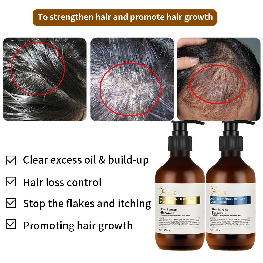 Custom Private Label Sulfate Free Ginger Anti Hair Fall Treatment Biotin Hair Growth Shampoo