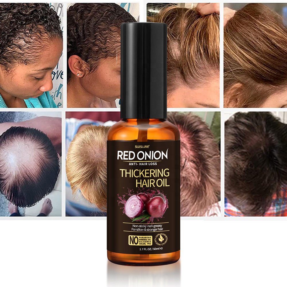 OCCA Private Label Wholesale Natural Organic Scalp Vegan Hair Care Loss Treatment Argan Castor Red Onion Hair Growth Oil Serum