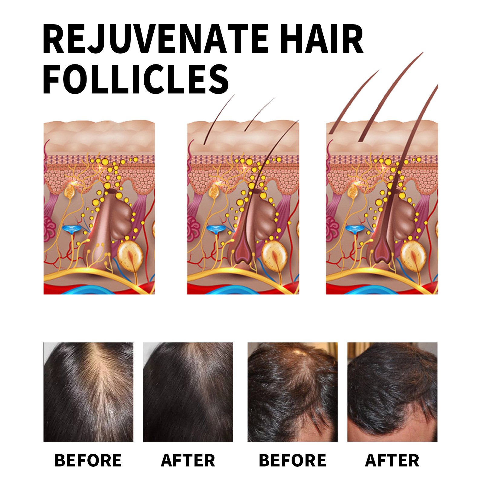 Scalp hair tonic essence hair growth massage scalp hair tonic