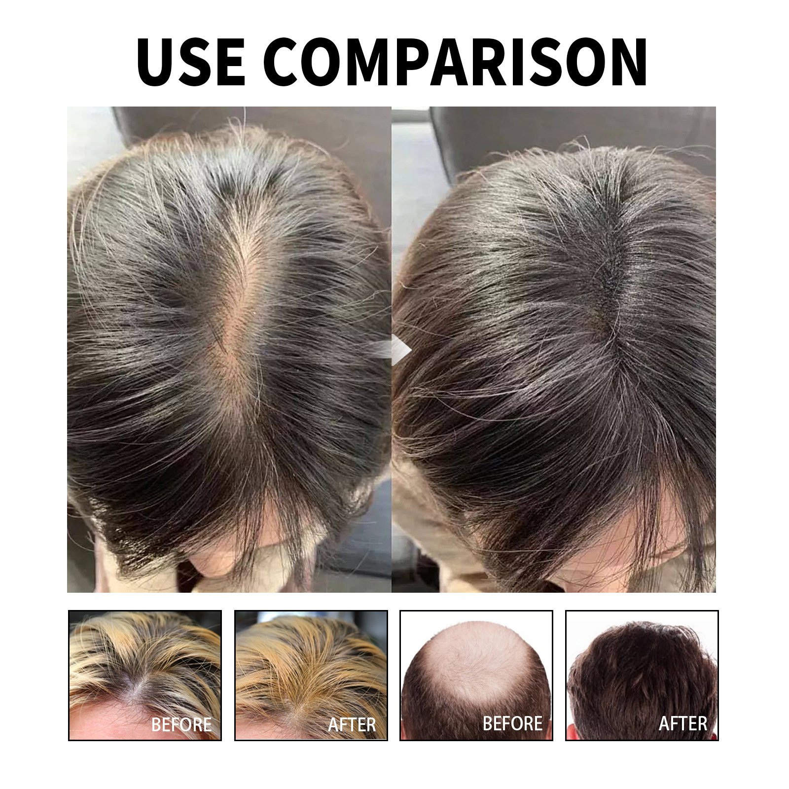 Scalp hair tonic essence hair growth massage scalp hair tonic
