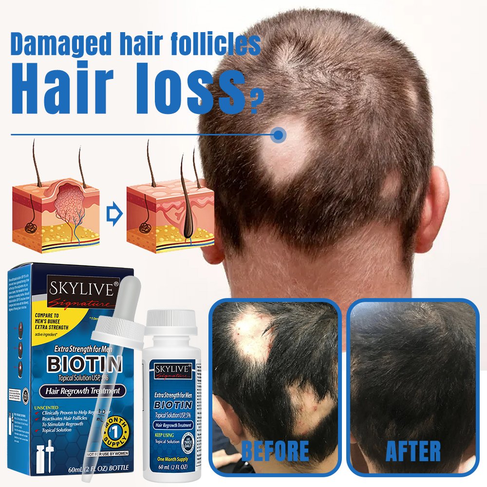 Latest Products Super Fast Hair Growth Serum Tonic hair growth product 60ml kirland 5% Extra Hair Growth Serum Oil