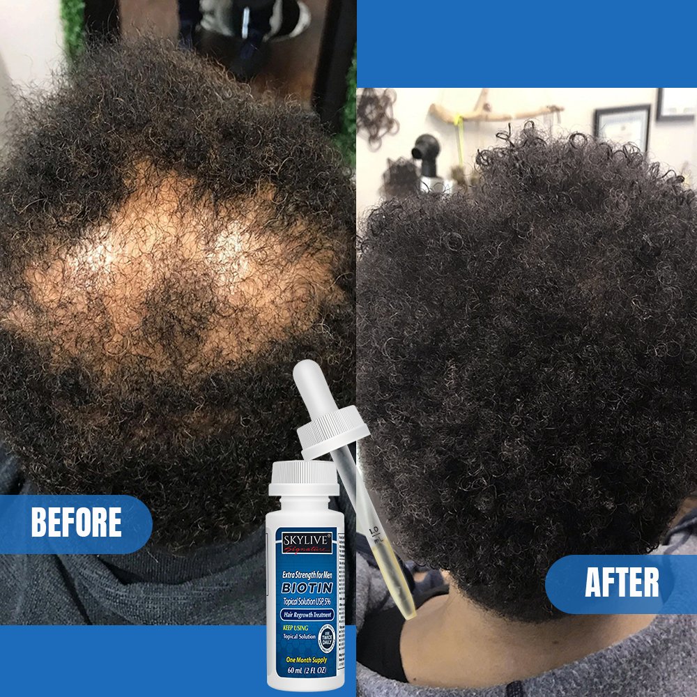 Latest Products Super Fast Hair Growth Serum Tonic hair growth product 60ml kirland 5% Extra Hair Growth Serum Oil