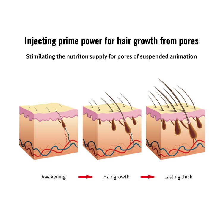Fast Delivery Anti Hair Loss Hair Growth Shampoo Nourishing Biotin Shampoo Conditioner Set