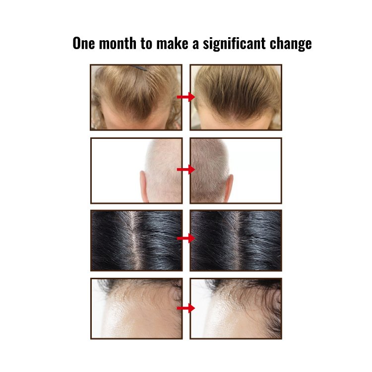 Fast Delivery Anti Hair Loss Hair Growth Shampoo Nourishing Biotin Shampoo Conditioner Set