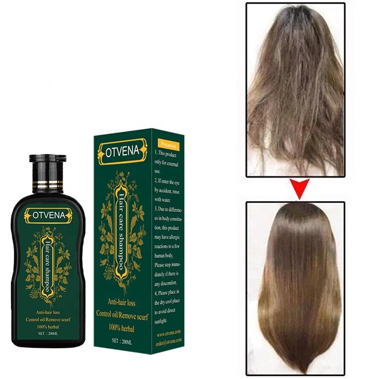 OTVENA OEM/ODM smooth hair shampoo & conditioner hair growth shampoo
