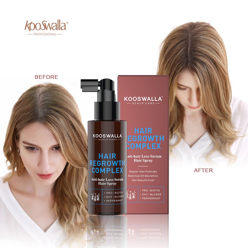Wholesale Spray Hair Growth for Thinning Loss Hair Essence Repair Damaged Hair Care Regrowth Oil
