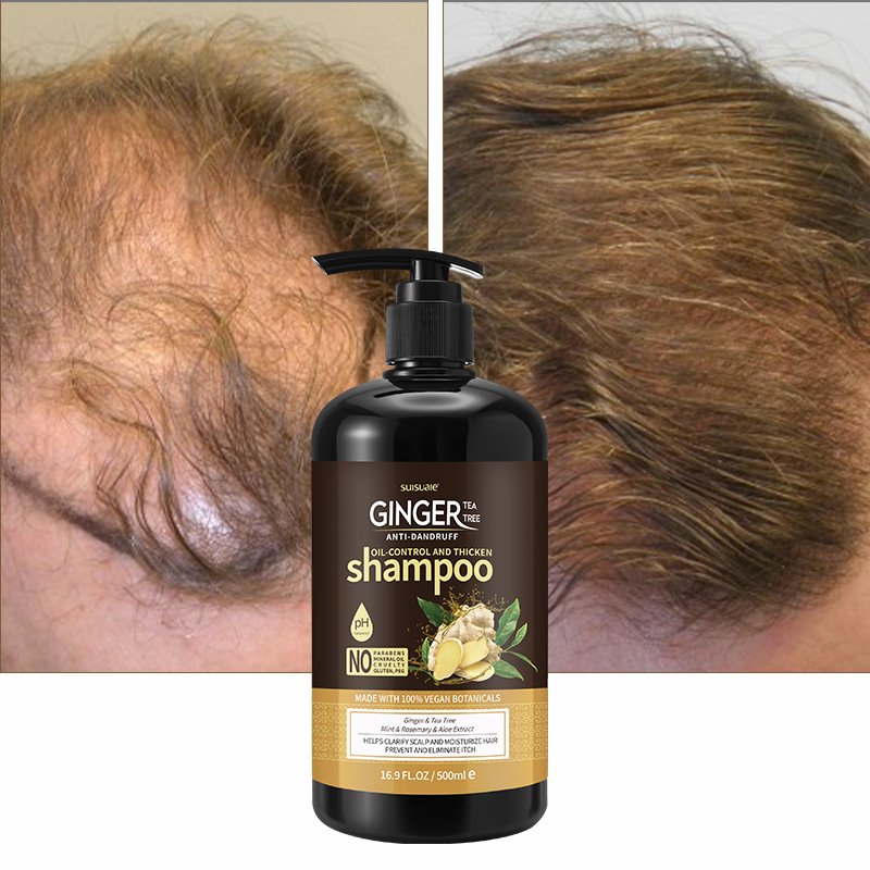 Customized Private Label Hair Care Set Ginger Tea Tree Oil Hair Growth Shampoo And Conditioner