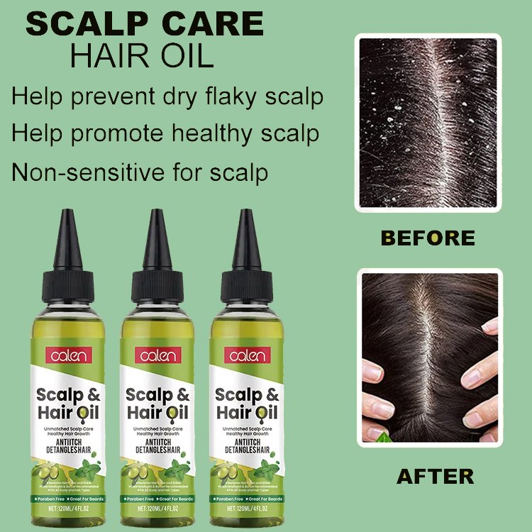 Private Label Organic Hair Repair Promote Growth Scalp Treatment Anti-itch Hair Scalp Oil