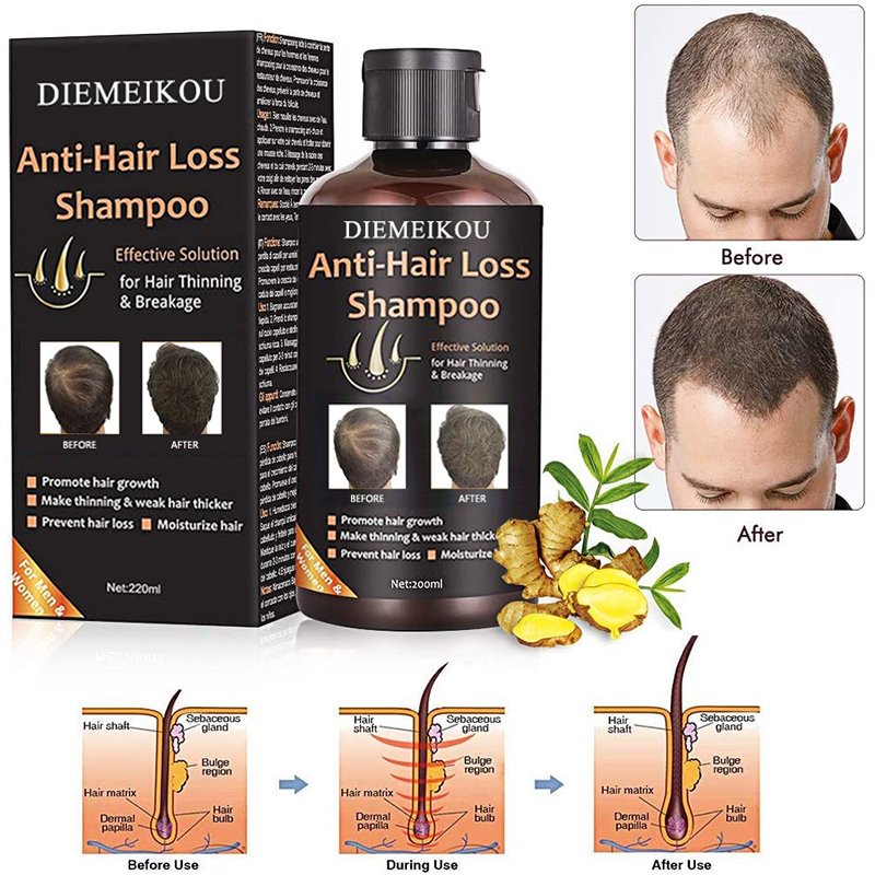 220ml private label shampooing et revitalisant ginger black nourishing argan oil hair growth anti hair loss shampoo