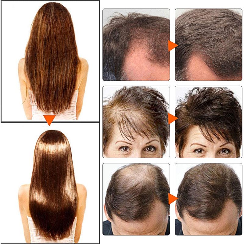 220ml private label shampooing et revitalisant ginger black nourishing argan oil hair growth anti hair loss shampoo