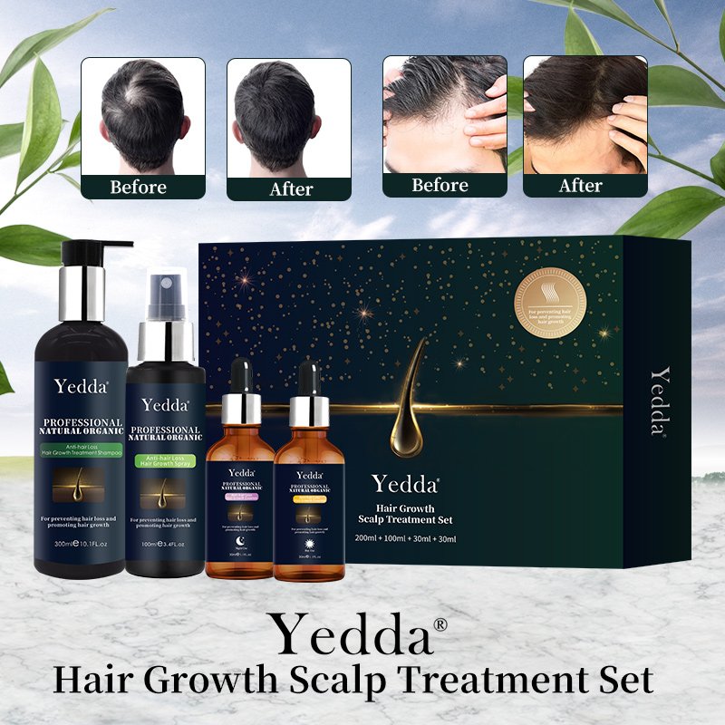 Private Label Organic Hair Fast Grow Anti Hair Loss Products Hair Growth Regrowth Shampoo