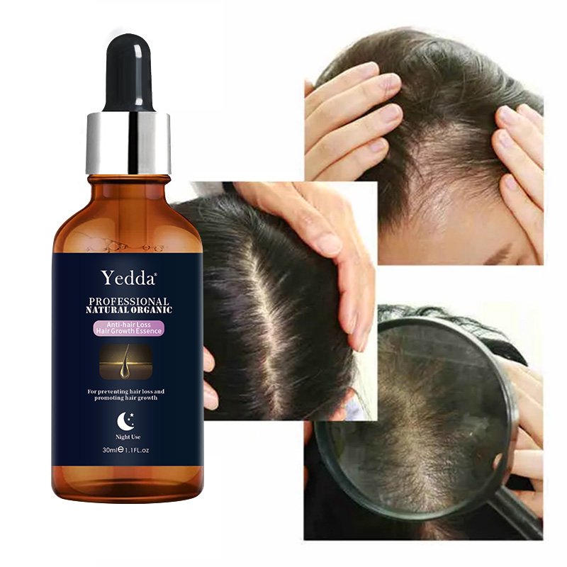 Private Label Organic Hair Fast Grow Anti Hair Loss Products Hair Growth Regrowth Shampoo