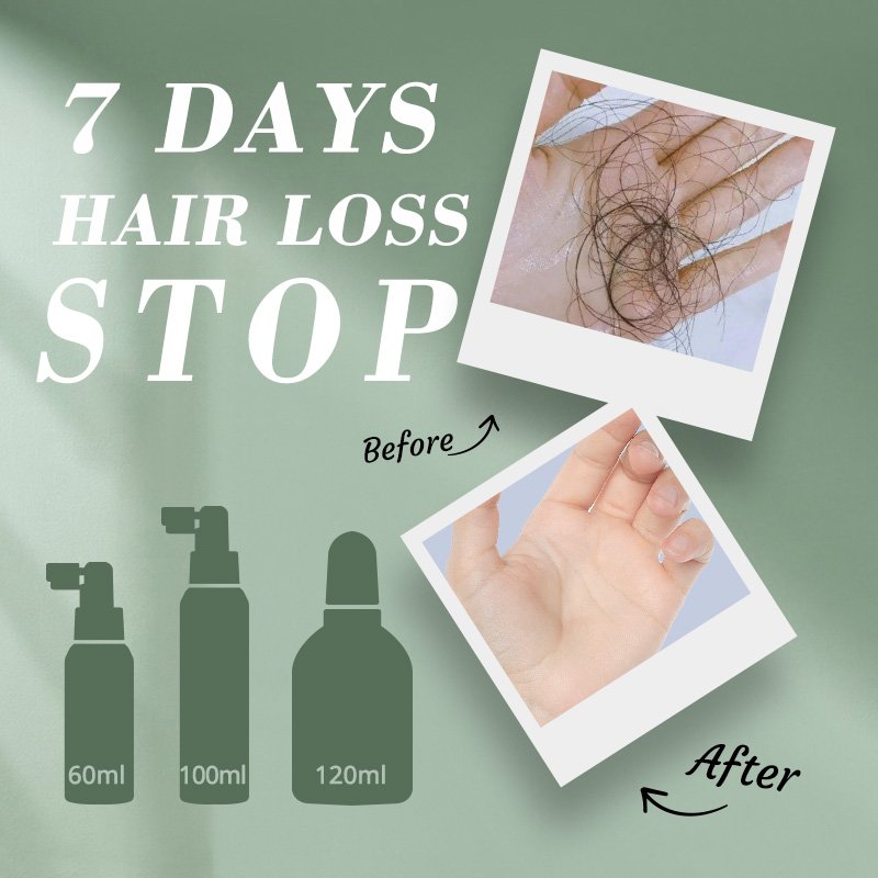 Private Label 100ml Ginger Extract Serum Organic Natural Anti-Hair Loss Treatment for Damaged Oily Curly Hair Herbal Ingredient