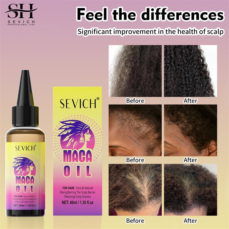 Hair Loss Treatment 100% Maca Powder Hair Growth Shampoo Conditioner Hair Regrowth Serum Oil Kit For Women