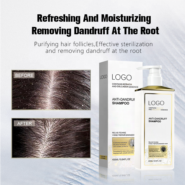 New Arriving Deeply Clean Skin Friendly Hair Wash Collagen Korean Anti Dandruff Shampoo For Men And Women