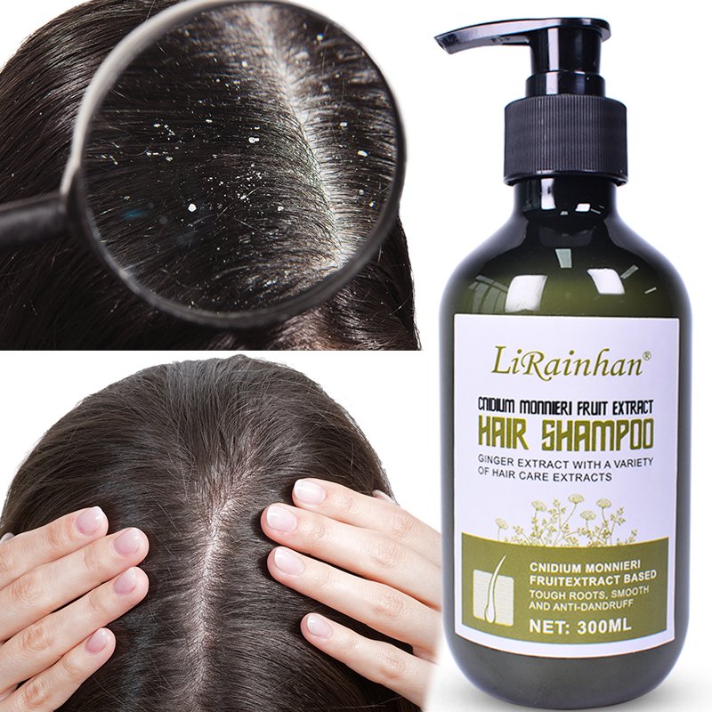 Anti-dandruff Silky Shampoo anti dandruff shampoo from original manufacturer