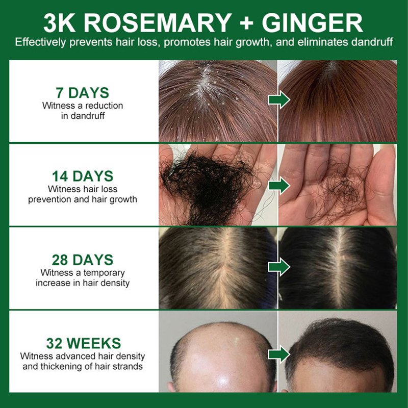 Hair Serum Products Veganic Natural Treatment Essential Rosemary Oil Hair Growth For Fast Hair Regrowth
