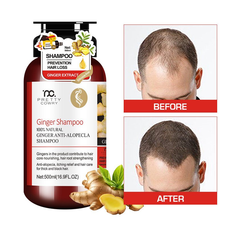 Pretty Cowry Fluffy Anti Dandruff Shampoo Natural Refreshing Clean Oil Control Shampoo