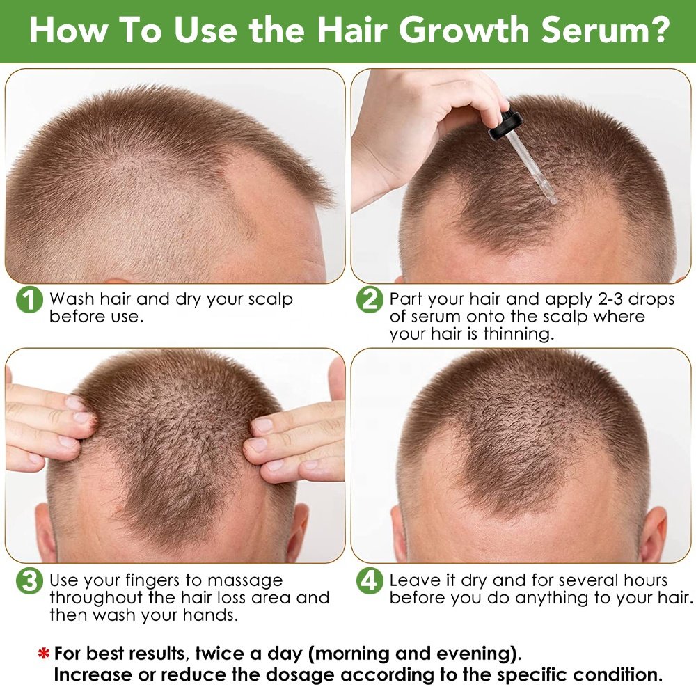 Hair Product Growth For Women Herbes Rapid Long Serum Hair Hair Growth Oil With No Label