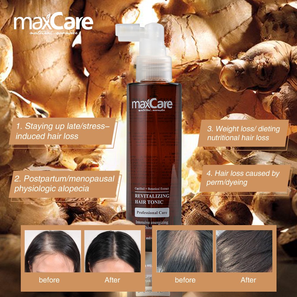Best Selling Maxcare 100% Organic Herbal Hair Regrowth Revitalizing Hair Tonic Damage Hair Treatment