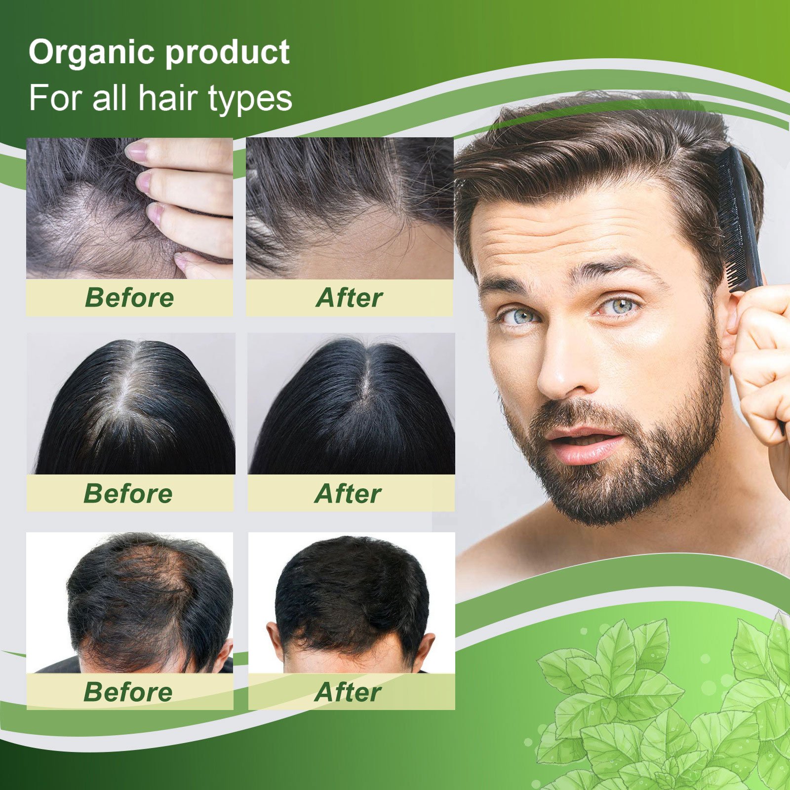 Ginger Haircare Lotion Organic Products Types Anti-hair Loss Stimulate Hair Regrowth Improves Hair Texture