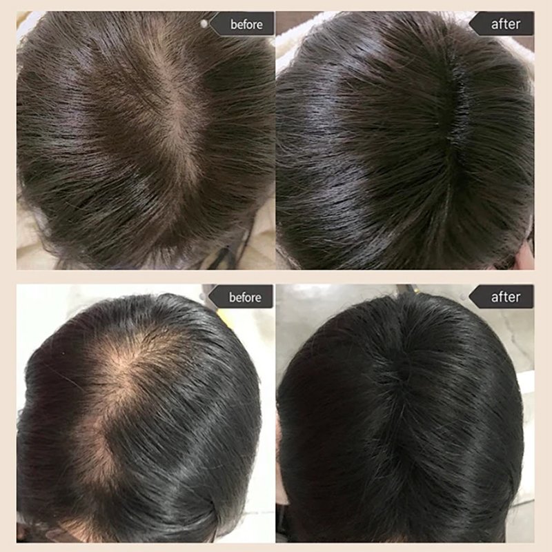 OEM ODM Polygonum multiflorum Shampoo 500ml Set Professional Salon Quality organic Shampoo and Conditioner Set Sulfate Free