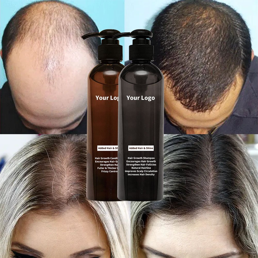 Private Label Best Strengthens Organic Biotin Anti Loss Fall Hair Growth Shampoo And Conditioner