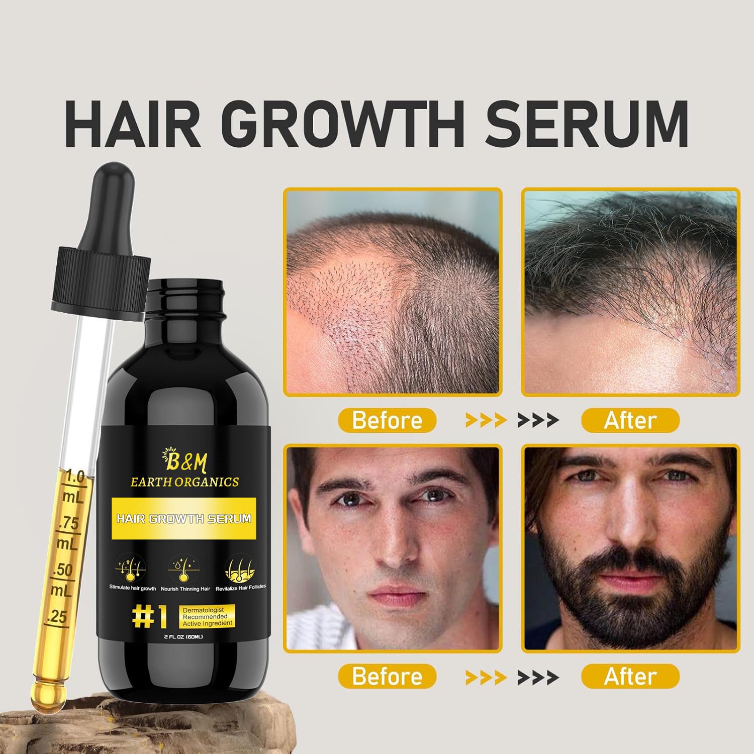Hair Regrowth and Thicker Fuller Hair Hair Loss Treatment for Men and Women
