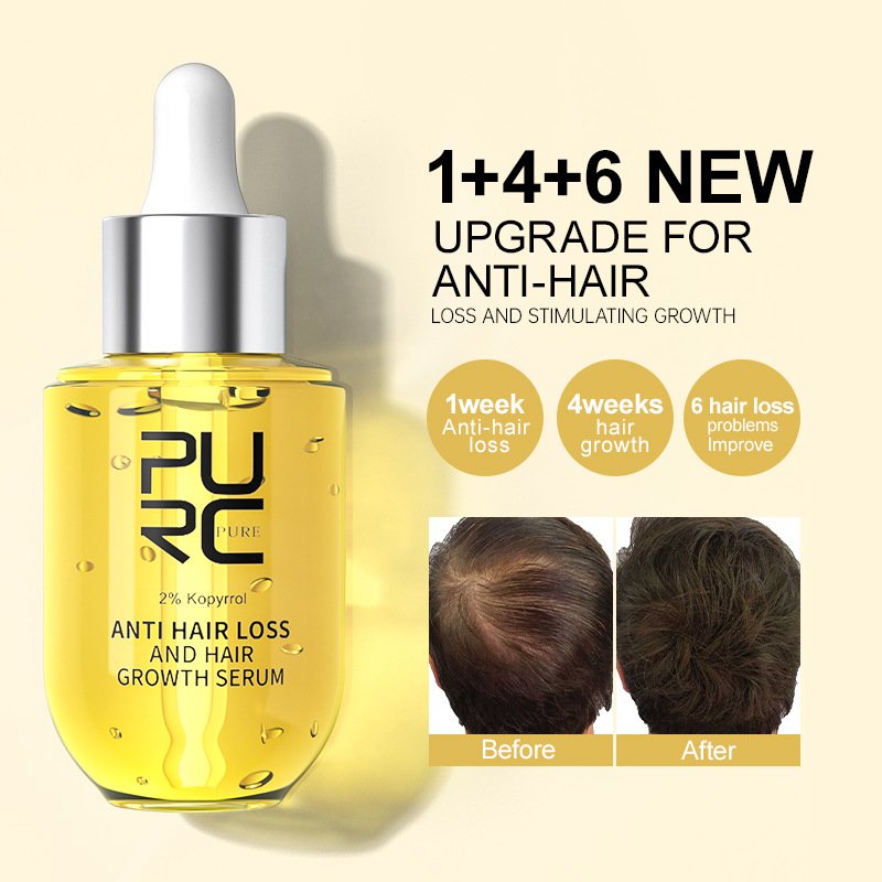 PURC Ginger Hair Liquid Regrowth Biotin Herbel Hair Tonic hair growth serum oil
