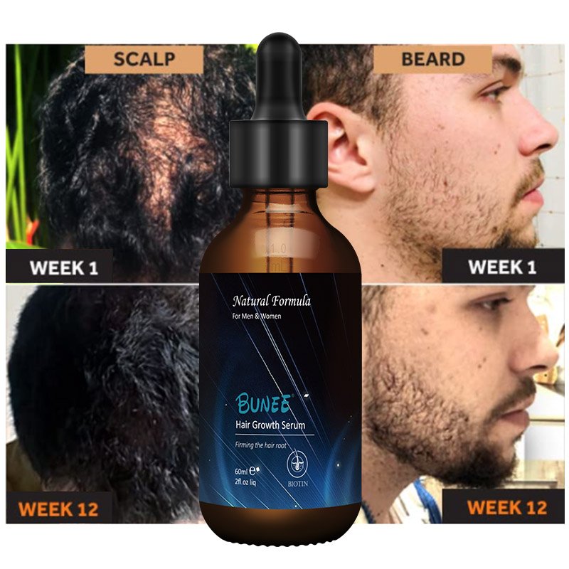 60ml Fast Regrowth Topical Solution Biotin Vitamin H Caster oil hair growth spray serum