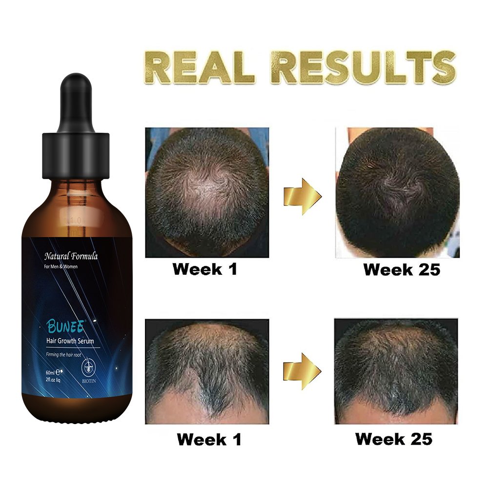60ml Fast Regrowth Topical Solution Biotin Vitamin H Caster oil hair growth spray serum