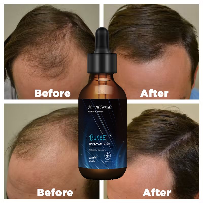 60ml Fast Regrowth Topical Solution Biotin Vitamin H Caster oil hair growth spray serum