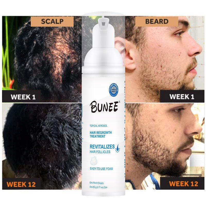 60ml Fast Regrowth Topical Solution Biotin Vitamin H Caster oil hair growth spray serum