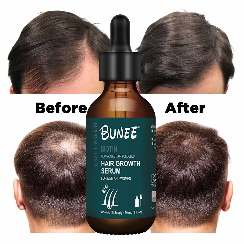 60ml Fast Regrowth Topical Solution Biotin Vitamin H Caster oil hair growth spray serum