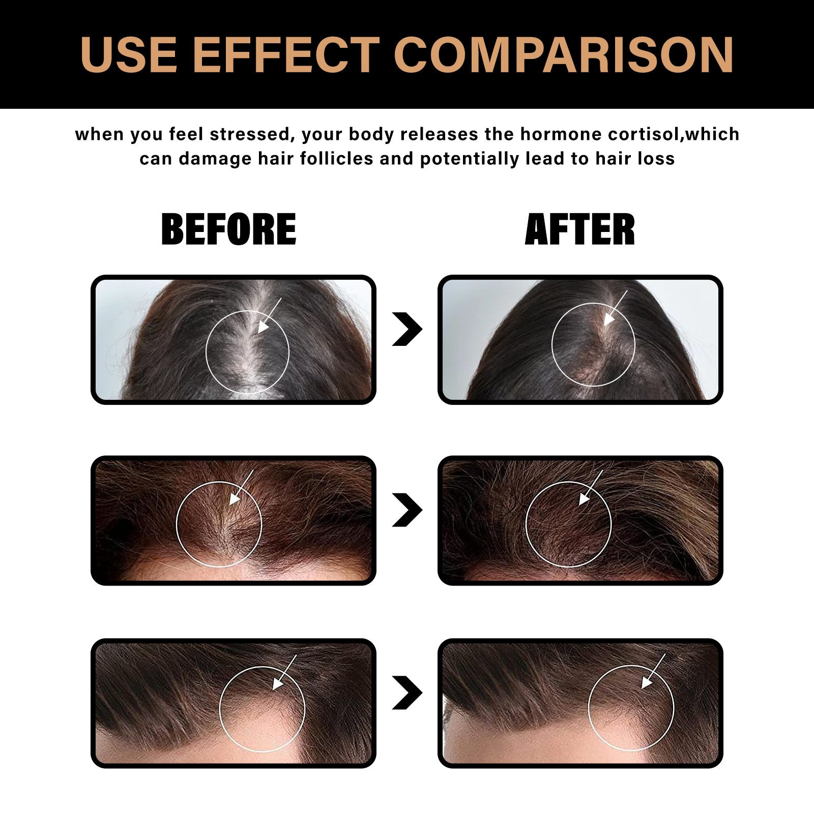 Biotin Shampoo for Hair Growth Hydrating Nourishing Thin Hair for Men
