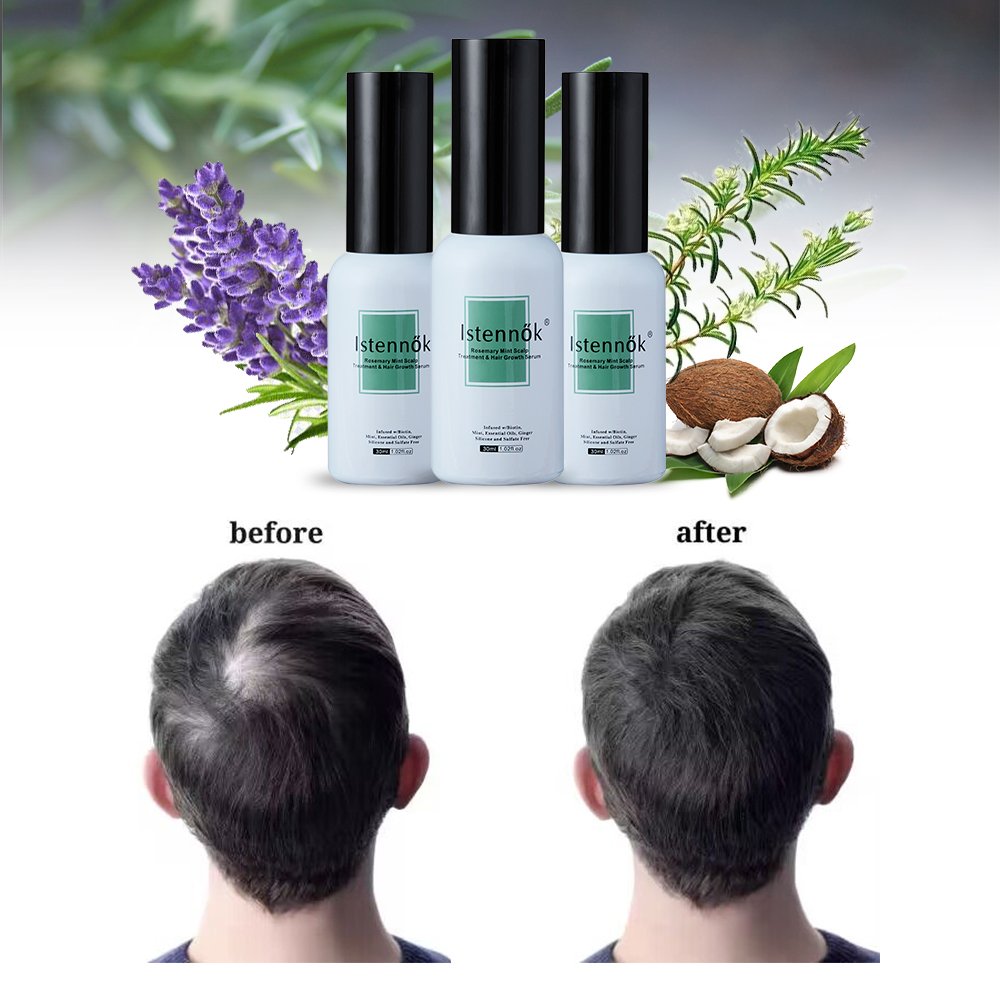 Best Regrowth Treatments Essence Hair Growth oil For Women Hair Loss Repair