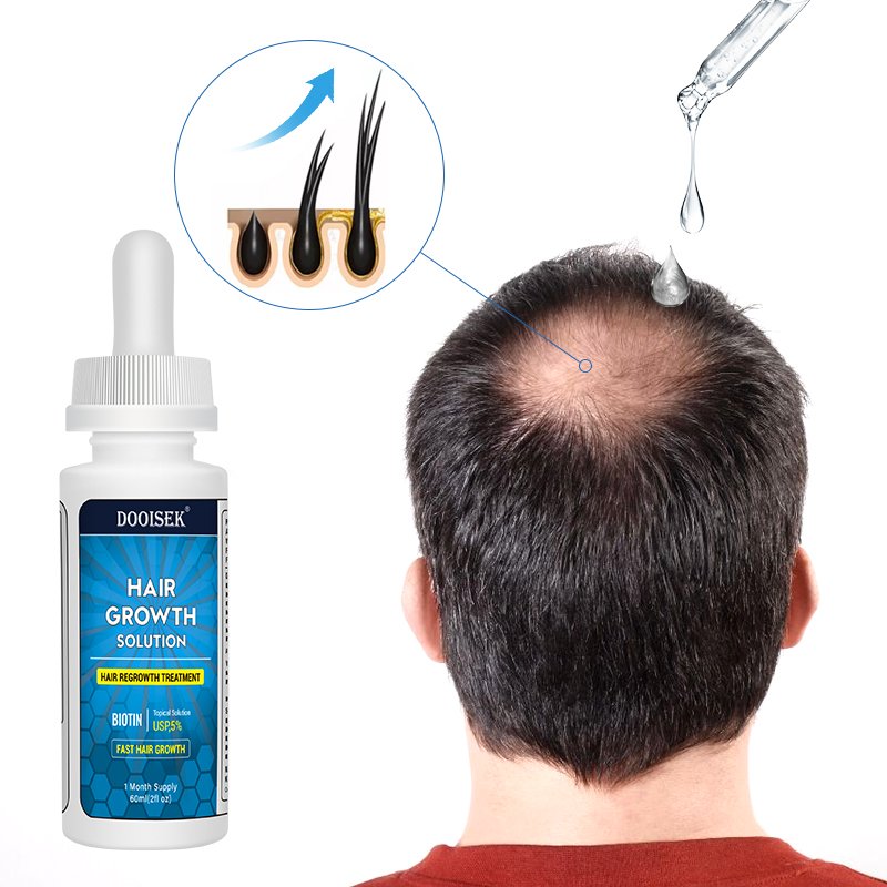 Customize Hair Products Organic Hair Loss Regrowth Serum For Black Women Fast Hair Growth