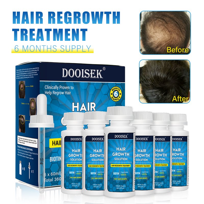 Customize Hair Products Organic Hair Loss Regrowth Serum For Black Women Fast Hair Growth