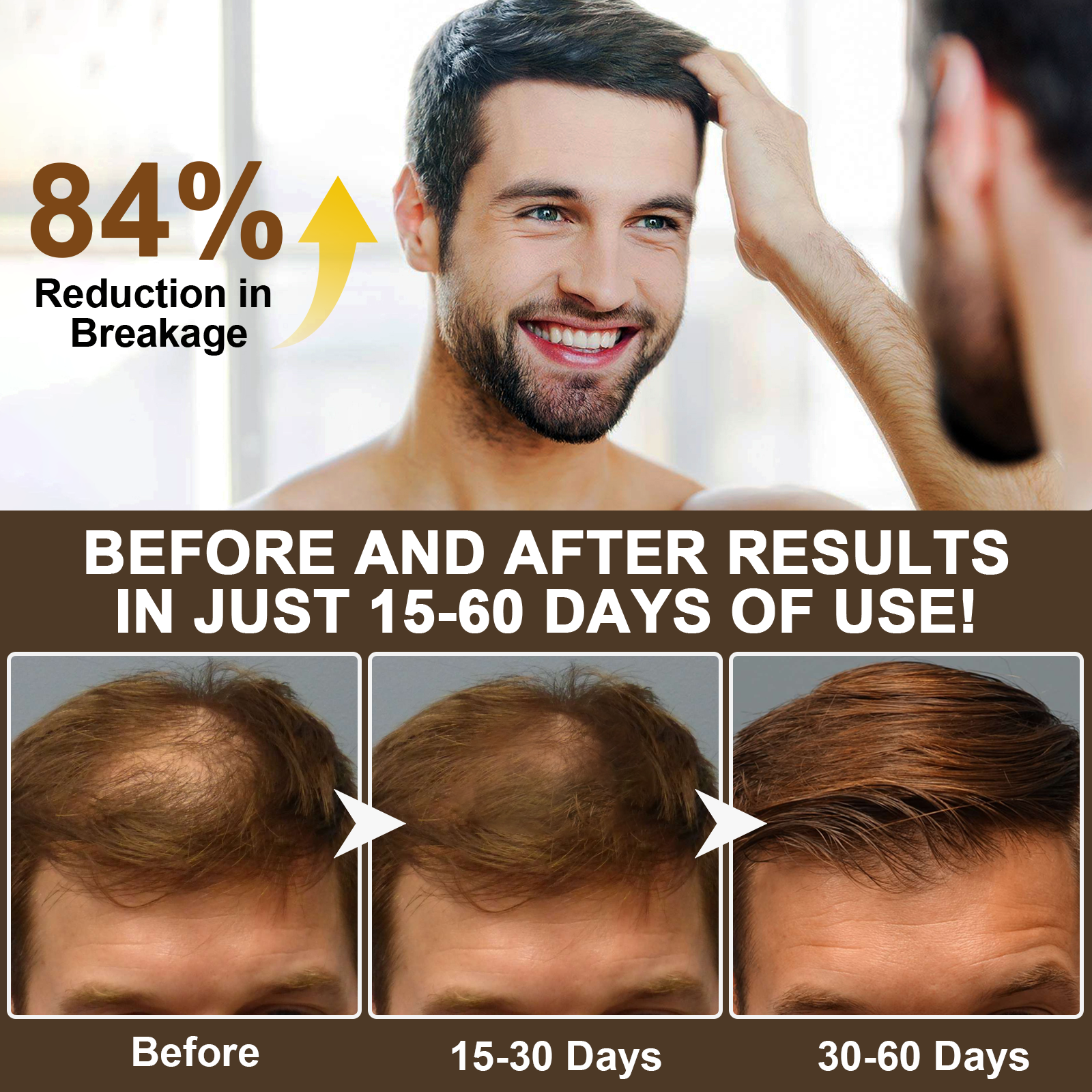 RTBYUE Wholesale 300ml Natural Hair Loss Prevent Bioton Shampoo Caffeine Shampoo for Women Men Hair Growth