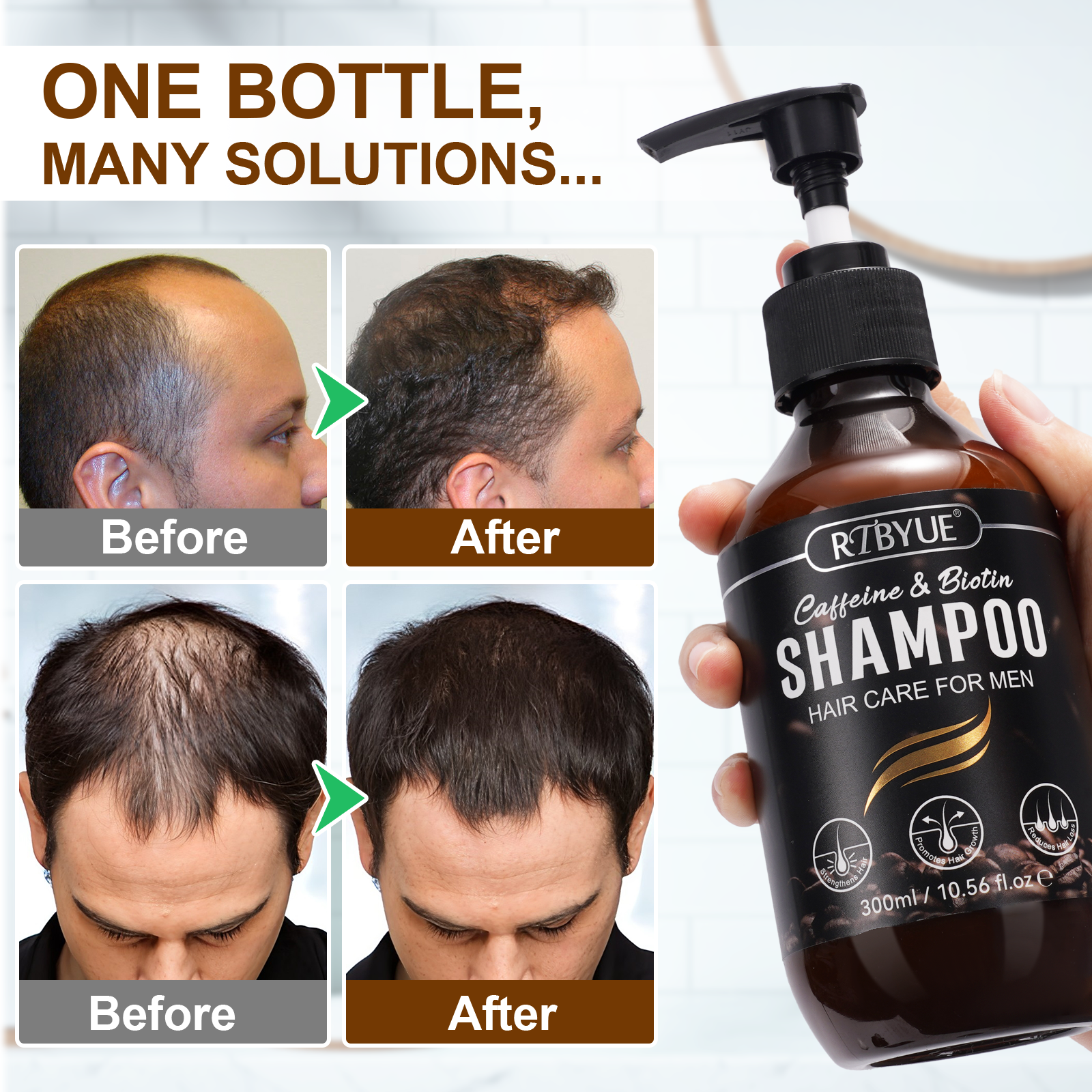 RTBYUE Wholesale 300ml Natural Hair Loss Prevent Bioton Shampoo Caffeine Shampoo for Women Men Hair Growth