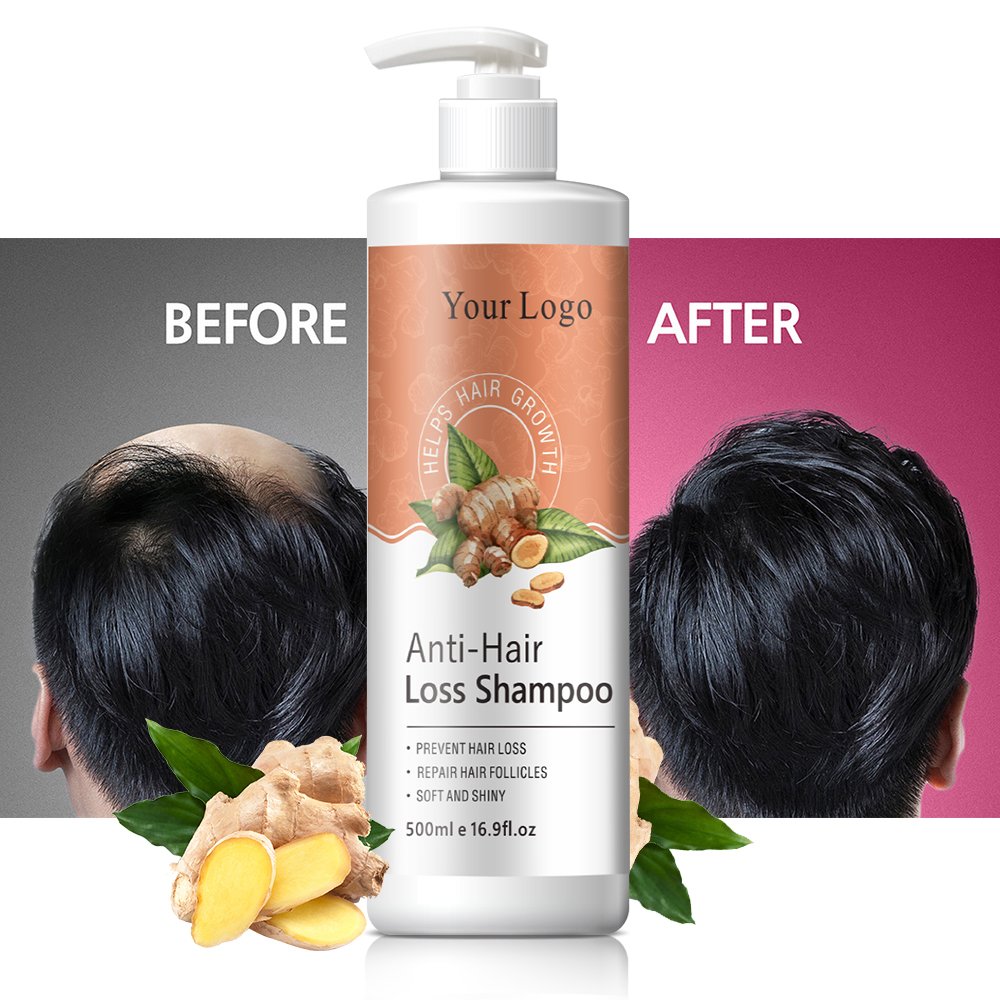 Fast Hair Regrowth Organic Oil Serum Anti Loss Custom Private Label Instant Natural Ginger Hair Growth Oil