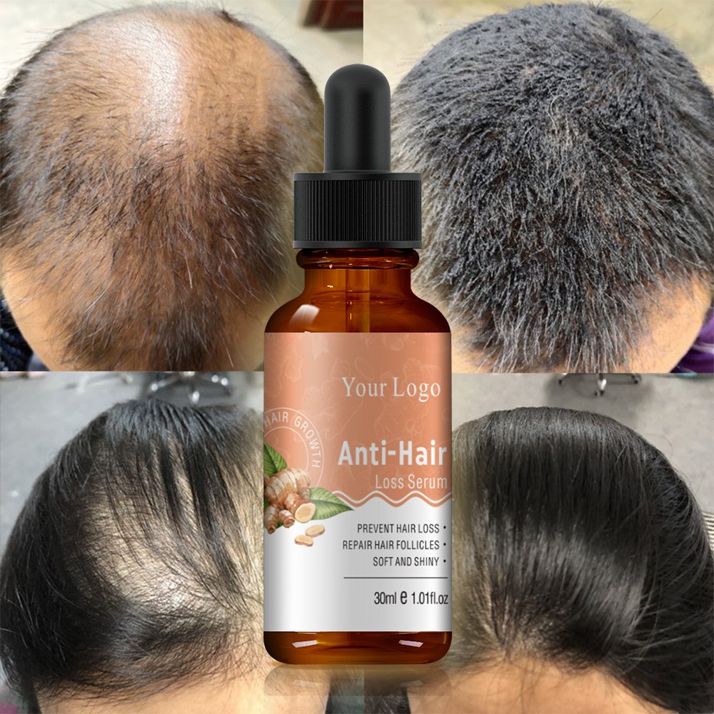 Fast Hair Regrowth Organic Oil Serum Anti Loss Custom Private Label Instant Natural Ginger Hair Growth Oil