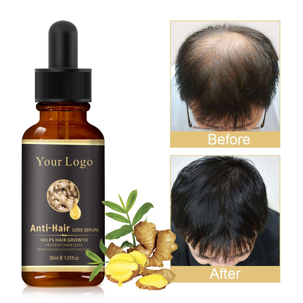 Fast Hair Regrowth Organic Oil Serum Anti Loss Custom Private Label Instant Natural Ginger Hair Growth Oil