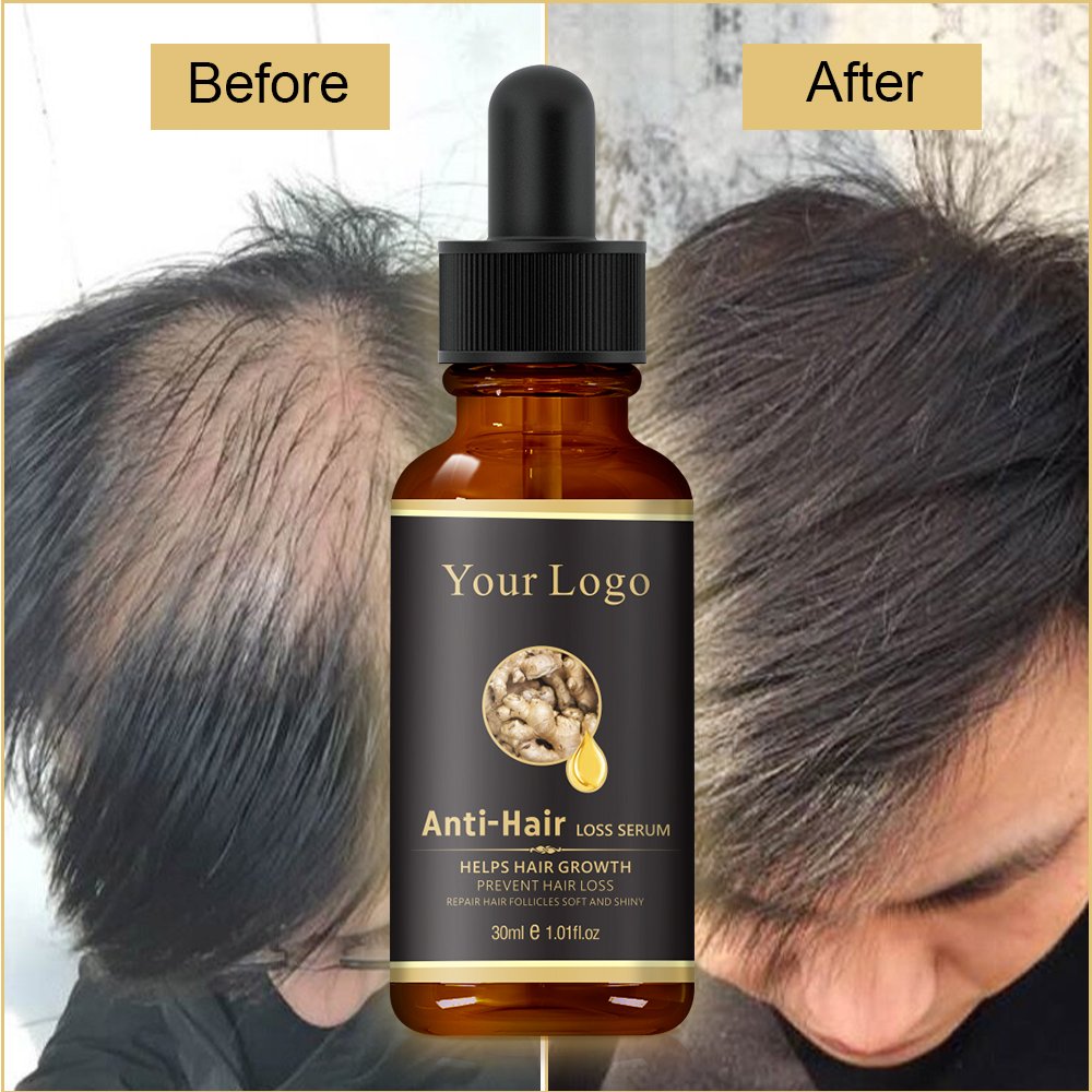 Fast Hair Regrowth Organic Oil Serum Anti Loss Custom Private Label Instant Natural Ginger Hair Growth Oil