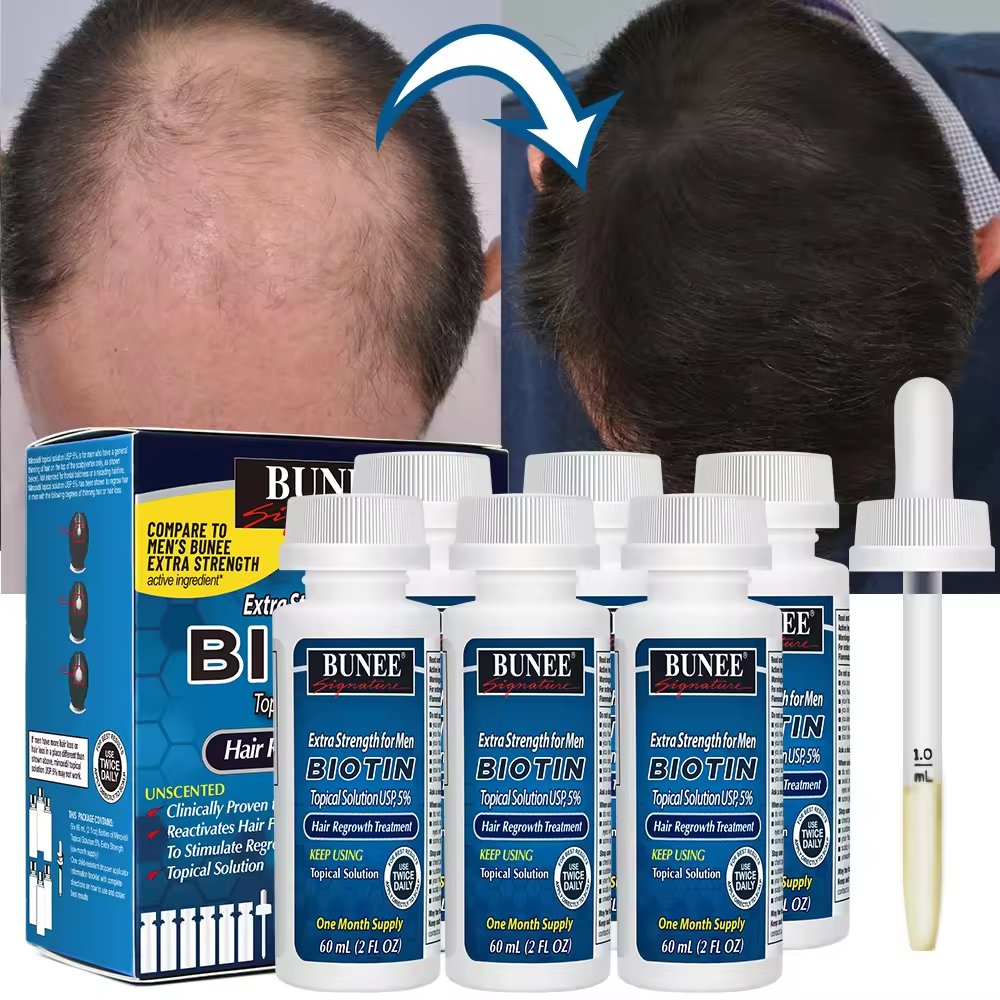 On Sale Super Fast Hair Growth Serum Tonic hair regrowth kirland 5% Prevents Hair Loss Nourishing Growth Oil