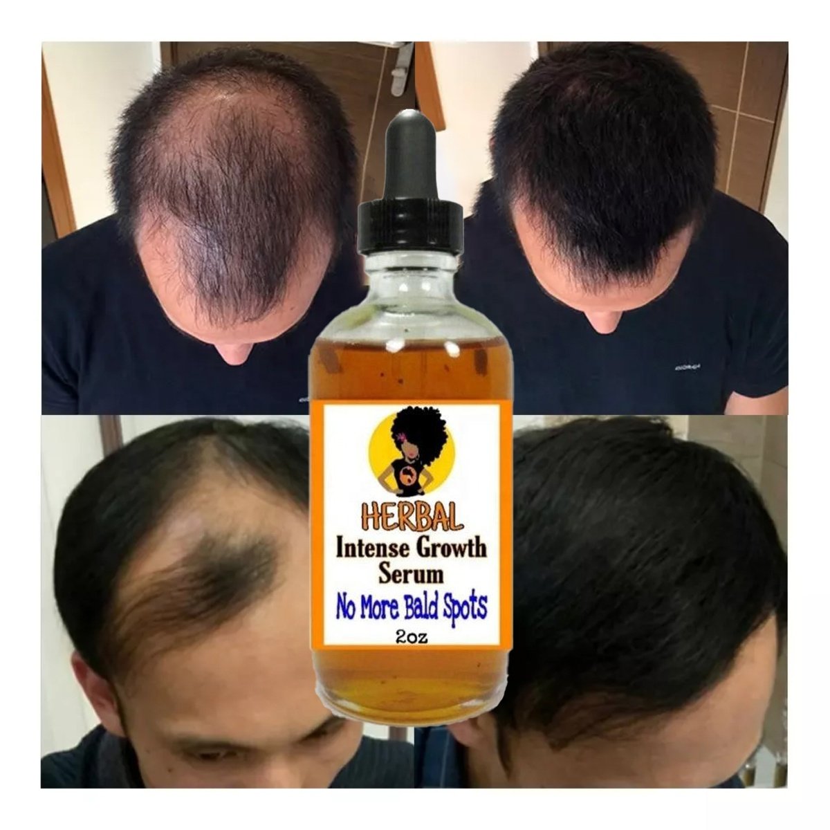 New Arrival Smoothing Repairing Anti Loss Hair Oil Regrowth Scalp Elixirs Private Label Hair Growth Oil Serum